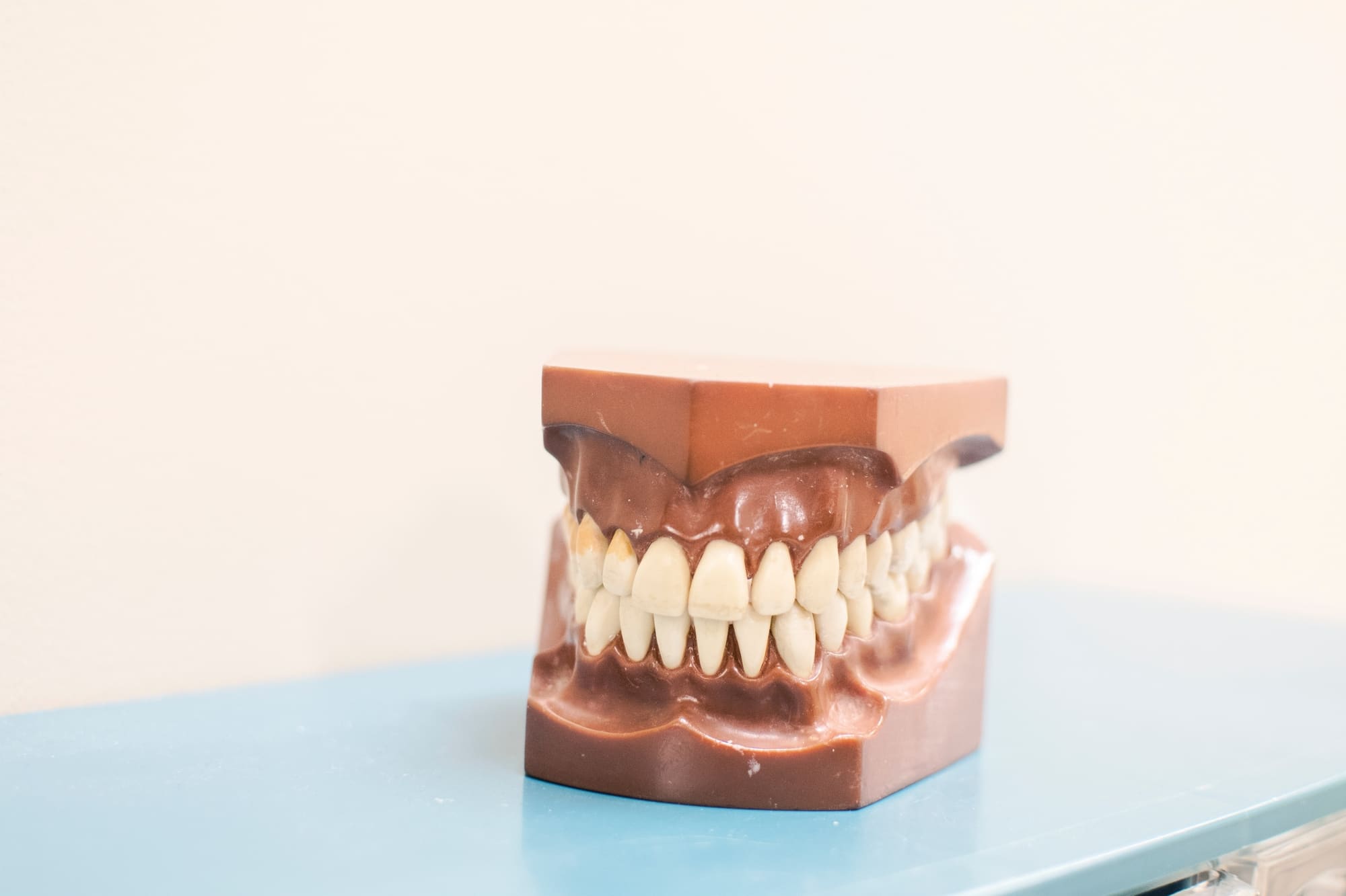 Wisdom Tooth Removal